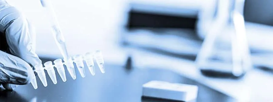 Yourgene Health Polymerase Chain Reaction PCR
