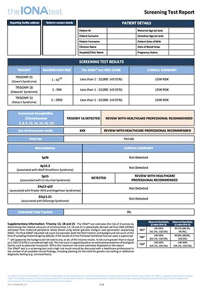 Yourgene Health IONA Nx Sample Screening Report.
